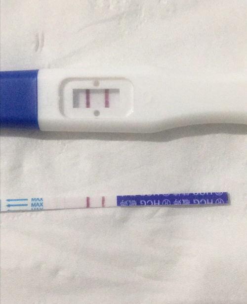 40歲還可以通過試管嬰兒生寶寶嗎？權威解答與注意事項
